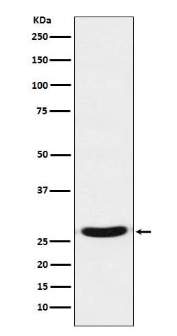 Anti-TCF21 Rabbit Monoclonal Antibody Boster Bio