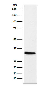 Anti-CRALBP RLBP1 Monoclonal Antibody Boster Bio