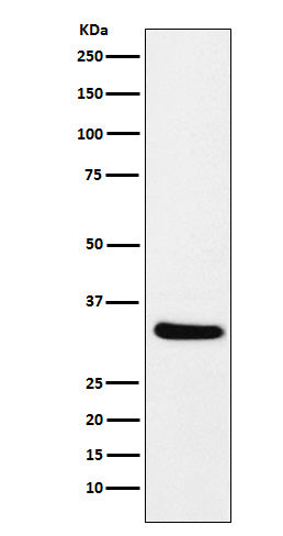 Anti-CRALBP RLBP1 Monoclonal Antibody Boster Bio