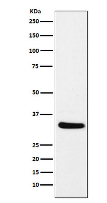Anti-CRALBP RLBP1 Monoclonal Antibody Boster Bio