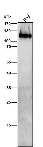 Anti-Integrin beta 7 Rabbit Monoclonal Antibody Boster Bio