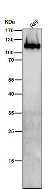 Anti-Integrin beta 7 Rabbit Monoclonal Antibody Boster Bio