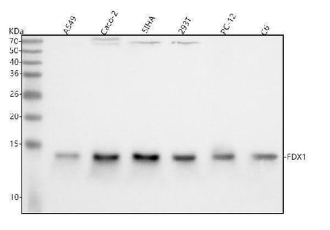 Anti-ADX Rabbit Monoclonal Antibody Boster Bio