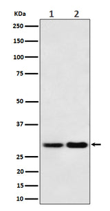 Anti-MTAP Rabbit Monoclonal Antibody Boster Bio