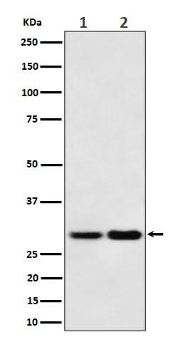 Anti-MTAP Rabbit Monoclonal Antibody Boster Bio