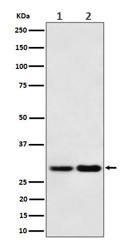 Anti-MTAP Rabbit Monoclonal Antibody Boster Bio
