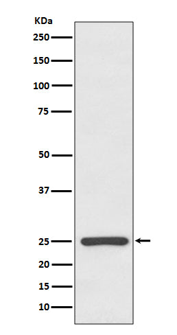 Anti-Kappa light chain IGKC Rabbit Monoclonal Antibody Boster Bio