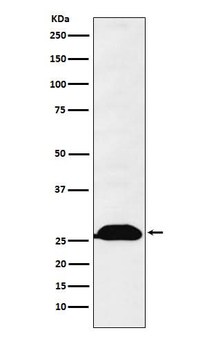 Anti-Human Kappa Chain Rabbit Monoclonal Antibody Boster Bio