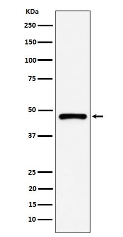 Anti-PSMC5 Rabbit Monoclonal Antibody Boster Bio