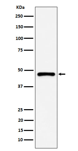 Anti-PSMC5 Rabbit Monoclonal Antibody Boster Bio