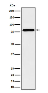 Anti-PRMT7 Rabbit Monoclonal Antibody Boster Bio