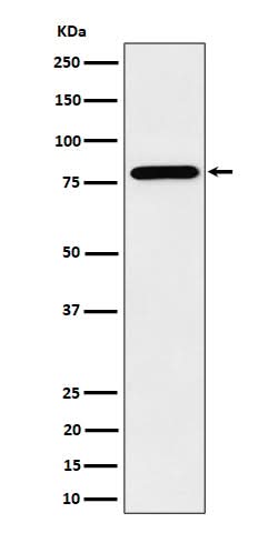 Anti-PRMT7 Rabbit Monoclonal Antibody Boster Bio