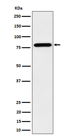 Anti-PRMT7 Rabbit Monoclonal Antibody Boster Bio
