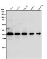 Anti-MLD Rabbit Monoclonal Antibody Boster Bio