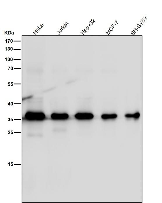 Anti-MLD Rabbit Monoclonal Antibody Boster Bio