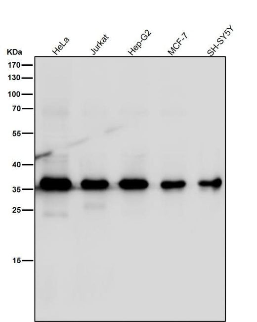 Anti-MLD Rabbit Monoclonal Antibody Boster Bio