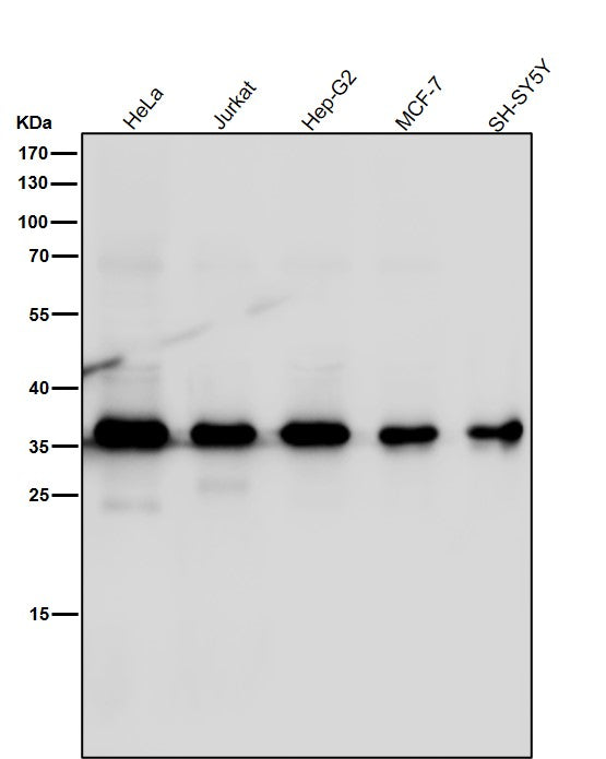 Anti-MLD Rabbit Monoclonal Antibody Boster Bio