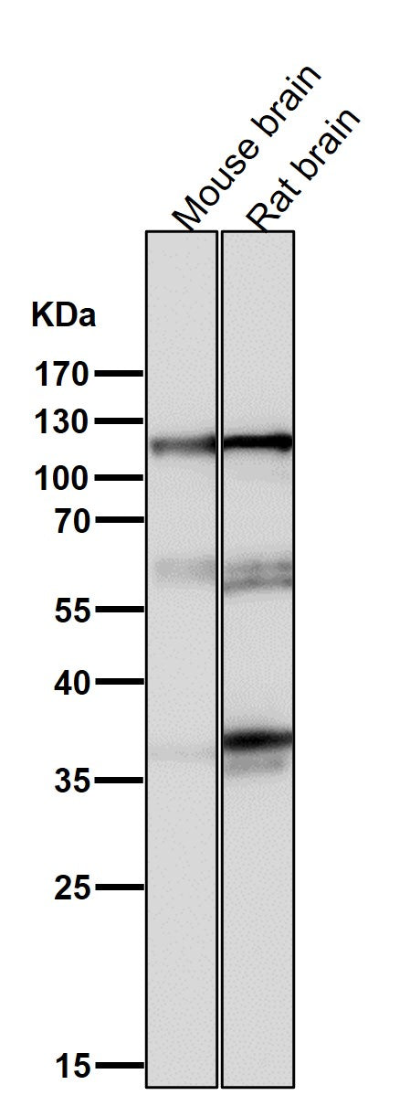 Anti-Drebrin DBN1 Rabbit Monoclonal Antibody Boster Bio