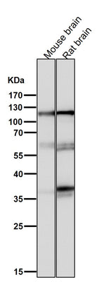 Anti-Drebrin DBN1 Rabbit Monoclonal Antibody Boster Bio