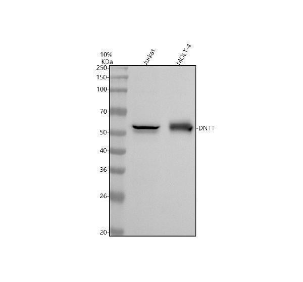 Anti-TDT DNTT Monoclonal Antibody Boster Bio