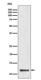 Anti-TCTEX1 Rabbit Monoclonal Antibody Boster Bio