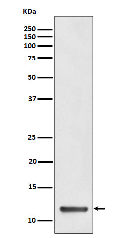 Anti-TCTEX1 Rabbit Monoclonal Antibody Boster Bio