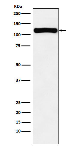 Anti-VPS11 Rabbit Monoclonal Antibody Boster Bio