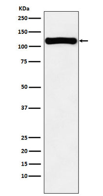 Anti-VPS11 Rabbit Monoclonal Antibody Boster Bio