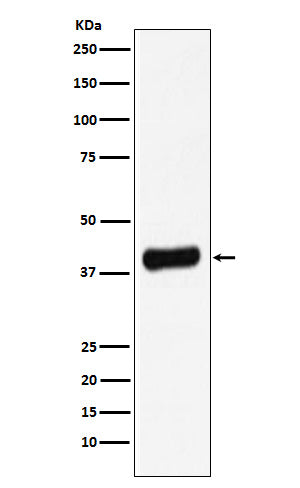 Anti-Galectin 8 Rabbit Monoclonal Antibody Boster Bio
