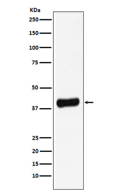 Anti-Galectin 8 Rabbit Monoclonal Antibody Boster Bio
