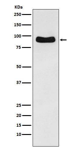 Anti-Cenexin1 / ODF2 Rabbit Monoclonal Antibody Boster Bio