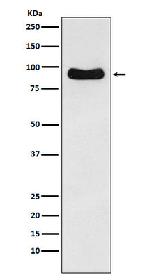 Anti-Cenexin1 / ODF2 Rabbit Monoclonal Antibody Boster Bio