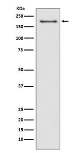Anti-NSD3/WHSC1L1 Rabbit Monoclonal Antibody Boster Bio