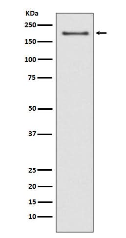 Anti-NSD3/WHSC1L1 Rabbit Monoclonal Antibody Boster Bio