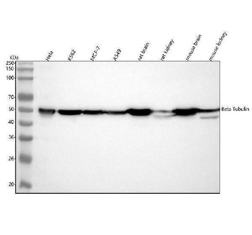 Anti-beta Tubulin Rabbit Monoclonal Antibody Boster Bio