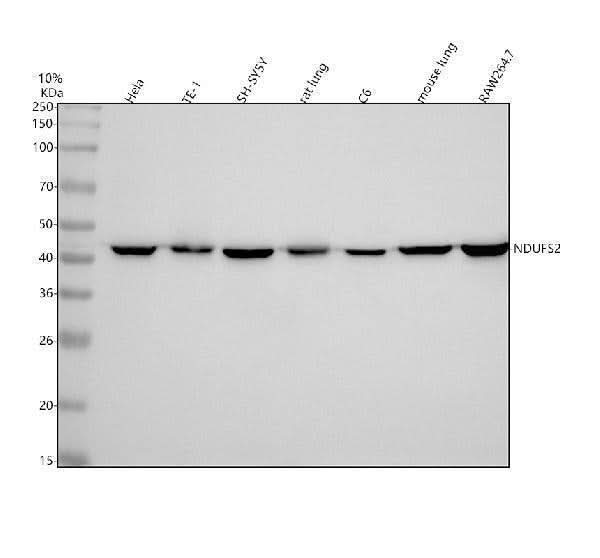 Anti-NDUFS2 Rabbit Monoclonal Antibody Boster Bio