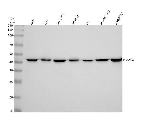 Anti-NDUFS2 Rabbit Monoclonal Antibody Boster Bio