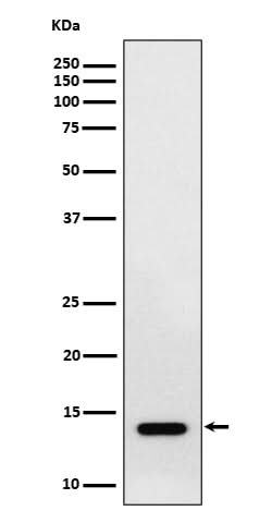 Anti-RNF7 Rabbit Monoclonal Antibody Boster Bio