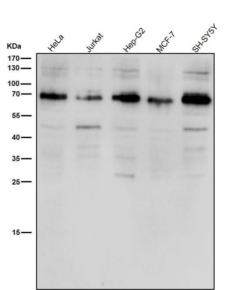 Anti-ACBD3 Rabbit Monoclonal Antibody Boster Bio
