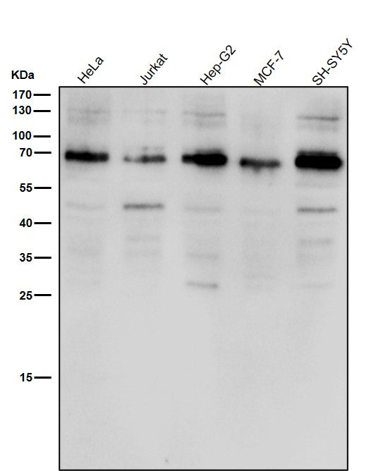 Anti-ACBD3 Rabbit Monoclonal Antibody Boster Bio