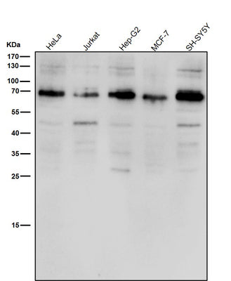 Anti-ACBD3 Rabbit Monoclonal Antibody Boster Bio