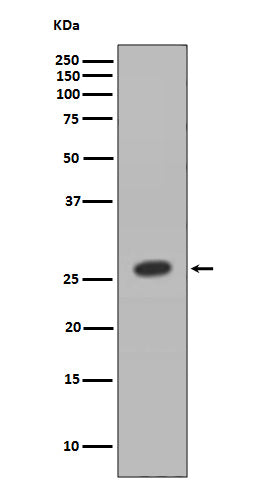 Anti-HOXB9 Rabbit Monoclonal Antibody Boster Bio