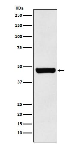 Anti-HSC70 Interacting Protein HIP Rabbit Monoclonal Antibody Boster Bio