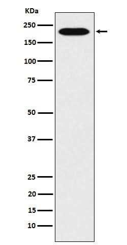 Anti-RhoGAP Rabbit Monoclonal Antibody Boster Bio