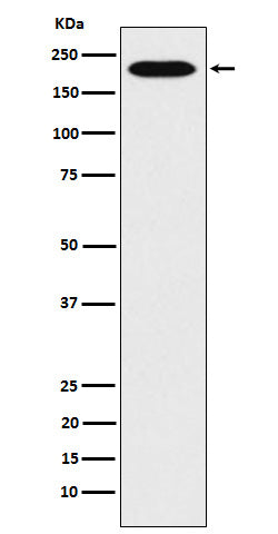 Anti-RhoGAP Rabbit Monoclonal Antibody Boster Bio