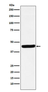 Anti-AHA1 Rabbit Monoclonal Antibody Boster Bio