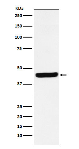 Anti-AHA1 Rabbit Monoclonal Antibody Boster Bio