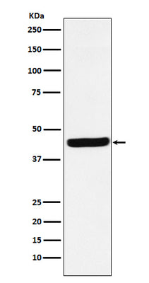 Anti-AHA1 Rabbit Monoclonal Antibody Boster Bio