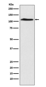 Anti-CHD1L Rabbit Monoclonal Antibody Boster Bio