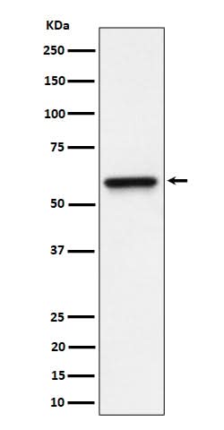 Anti-RGS6 Rabbit Monoclonal Antibody Boster Bio
